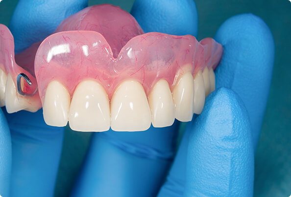 8 different types of dentures