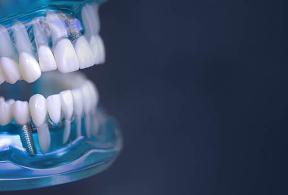 Non-Invasive Dental Procedure