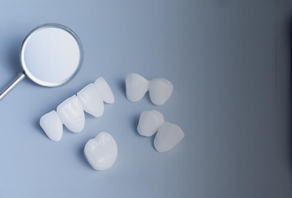 Tanty Family Dental provides non-invasive composite porcelain dental veneers in Waukesha, WI
