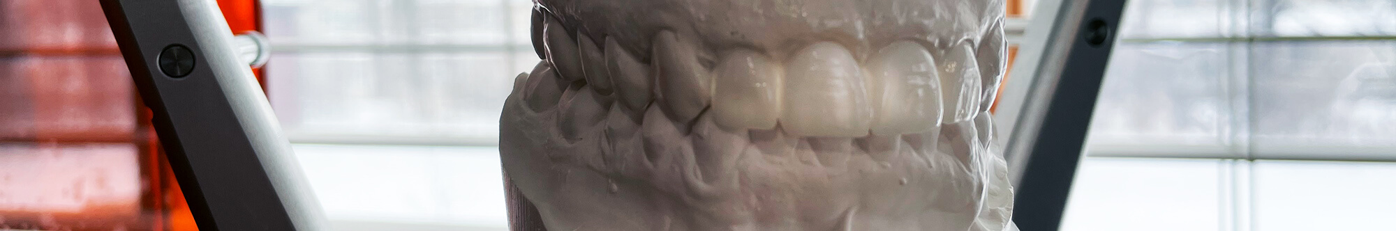 Waukesha Tooth Bondings