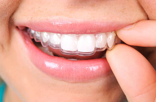 Dr. Tanty will enhance your smile with clear teeth aligners